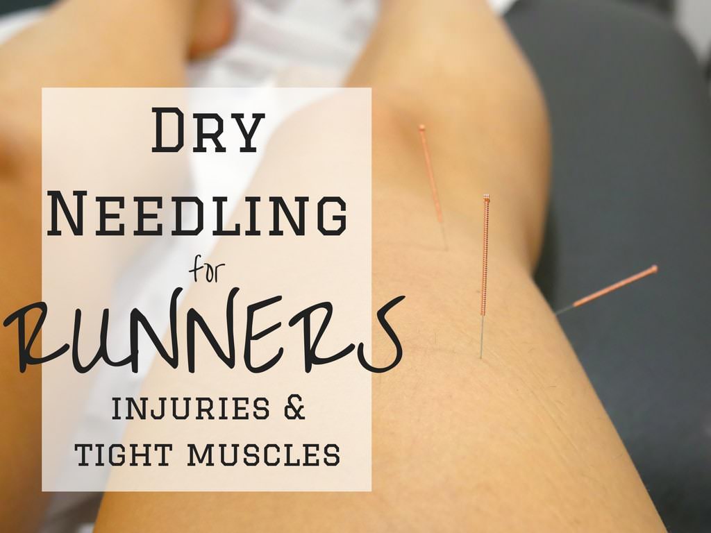 Dry Needling for Runners